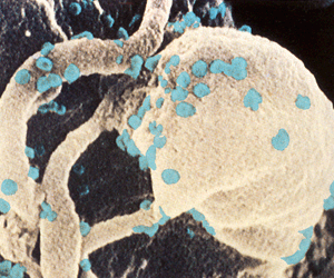 Вирус СПИДа (на фотографии отмечен голубым)